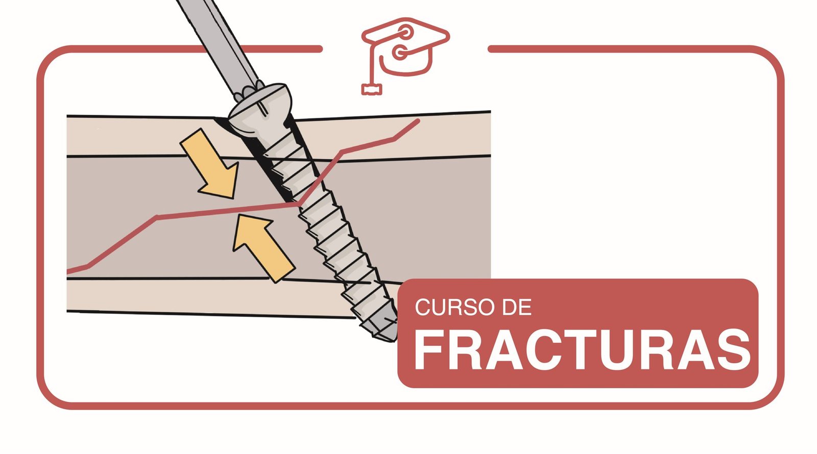 Curso de Diagnóstico y Tratamiento de Fracturas