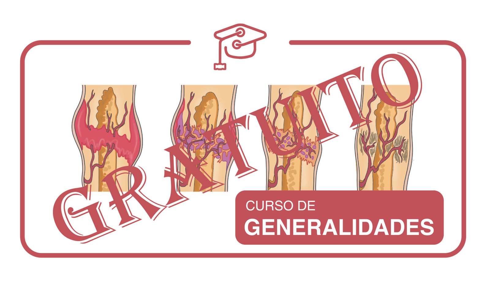 Generalidades del tratamiento de las fracturas