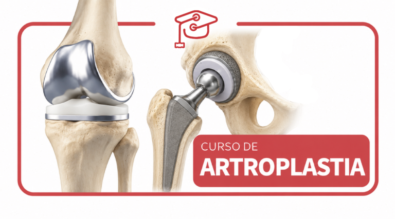 Curso de Artroplastia Total de Cadera y de Rodilla