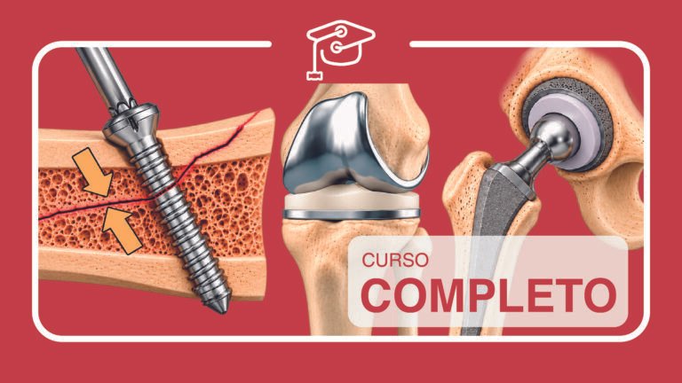 Curso Completo Academia de Trauma